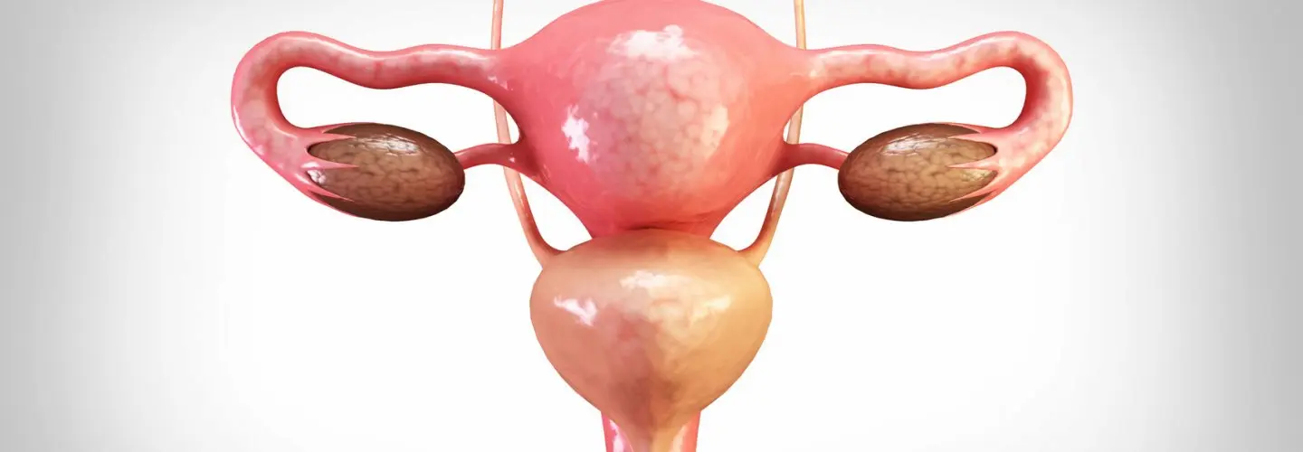 Laparoskopik Myomektomi