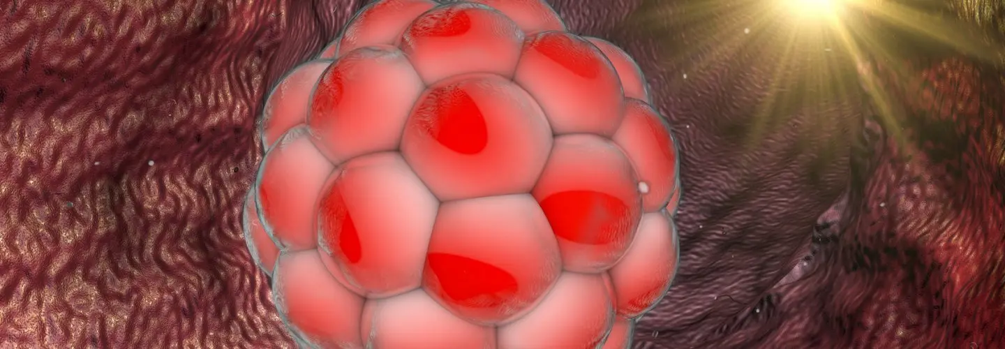 Assisted Hatching (Destekli Yuvalama) Nedir?