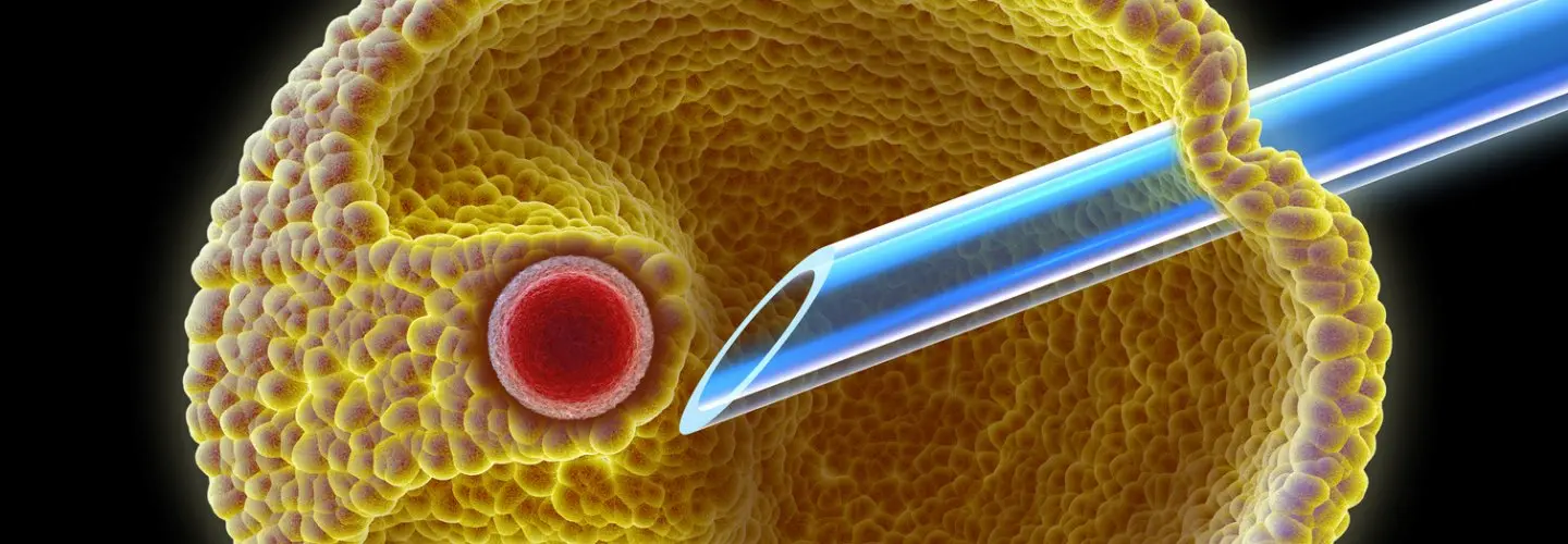 Kısırlık Çözümsüz Değildir...6 (Yazı Dizisi) -  Mikroenjeksiyon